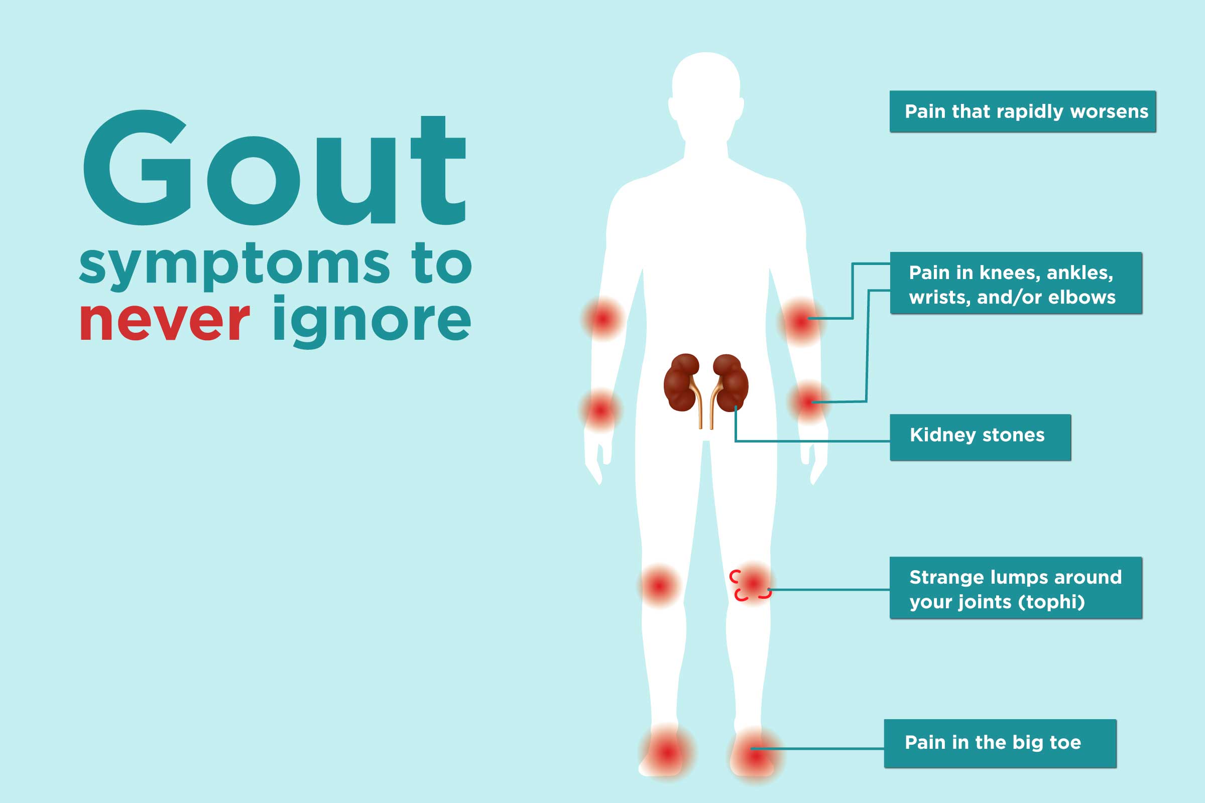 What is a Gout Attack? Symptoms And More